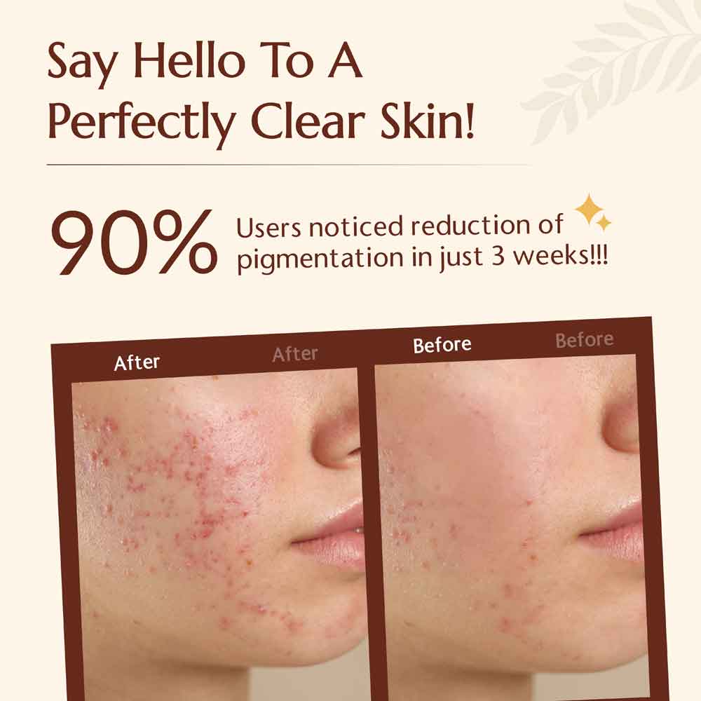 hamsa radiance gluta hyaluronic luxury soap perfectly clear skin