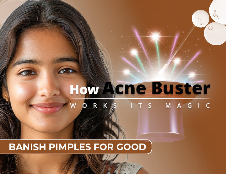 Banish Pimples for Good How Acne Buster Works Its Magic