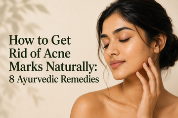 How to Get Rid of Acne Marks Naturally: 8 Ayurvedic Remedies