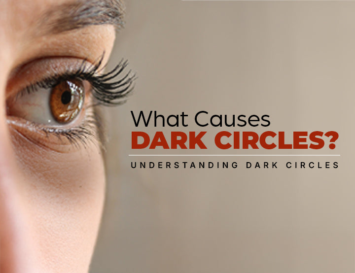 What Causes Dark Circles Understanding Dark Circles