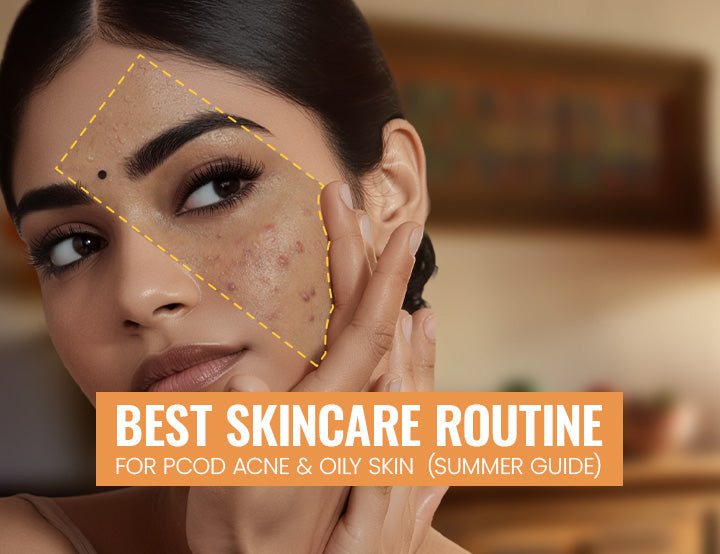 Best Skincare Routine for PCOD Acne & Oily Skin (Summer Guide) – Hamsa ...