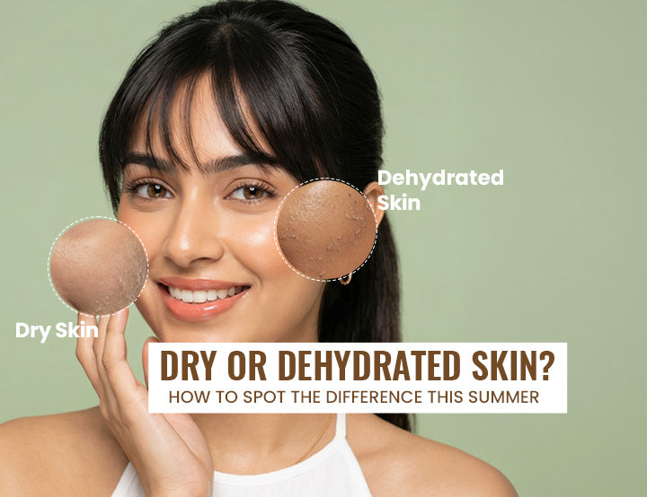 Dry or Dehydrated Skin? How to Spot the Difference This Summer