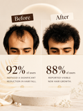 Advanced Hair Growth Serum - befor and after