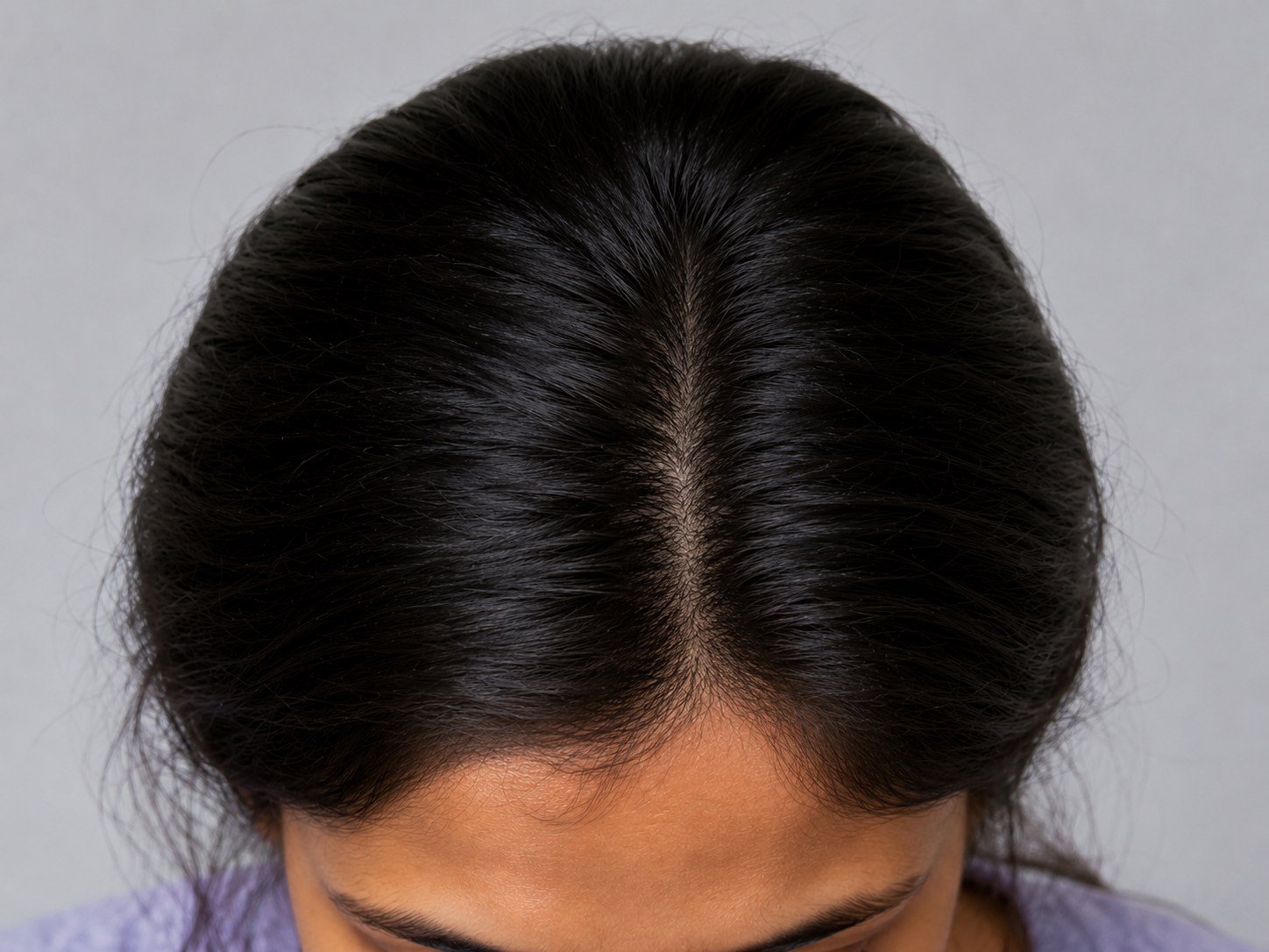 image comparison after