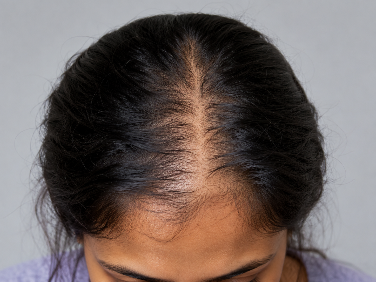 image comparison before