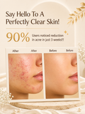 Perfectly Clear Skin With The Complete Hair, Skin & Face Radiance Kit